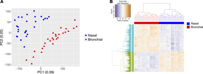 Nasal versus bronchial transcriptome in children with severe persistent ...