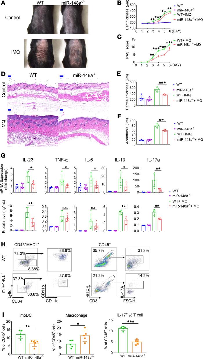 
miR-148a deficiency alleviates the development of psoriasis.
WT and miR...