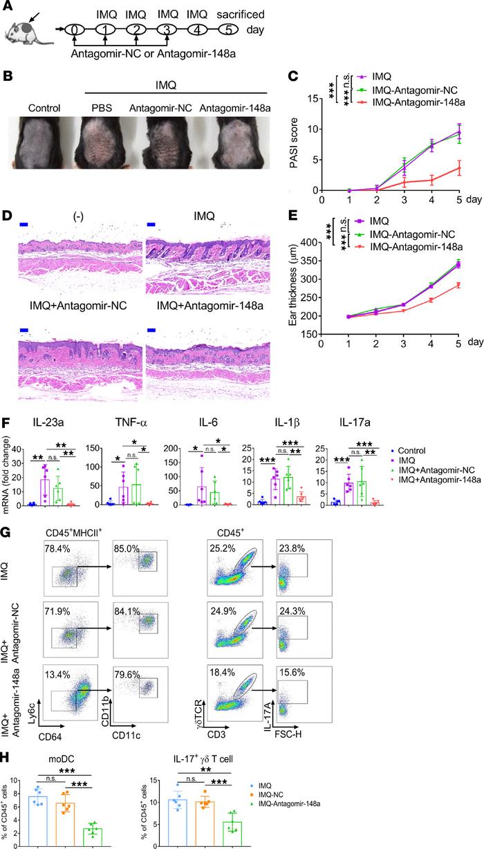 Intradermal administration of antagomir-148a ameliorates the pathologica...