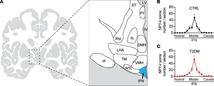 The section selection strategy.
(A) Schematic of human hypothalamus show...