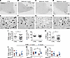 Decreased POMC-ir in the IFN of T2DM subjects can be prevented by insulin t
