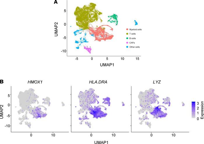 
HMOX1 is expressed by myeloid cells that infiltrate human breast tumors...