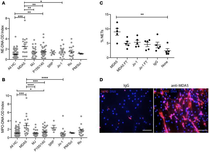 Anti-MDA5 MSAs are associated with higher levels of circulating NETs and...
