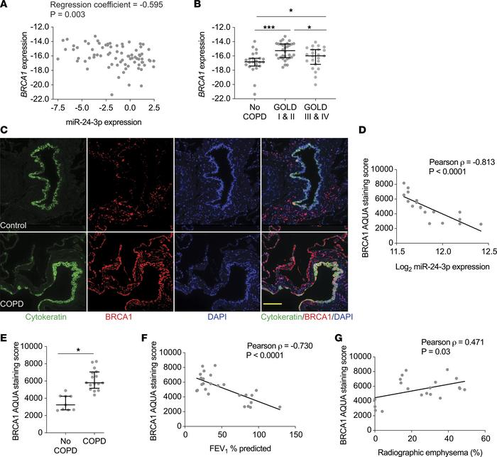 
BRCA1 expression inversely correlates with miR-24-3p expression and BRC...