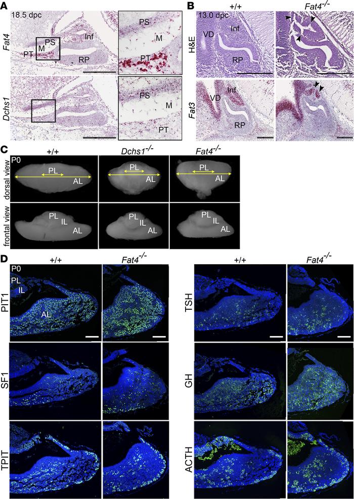 FAT4 and DCHS1 are required for normal murine pituitary development.
(A)...