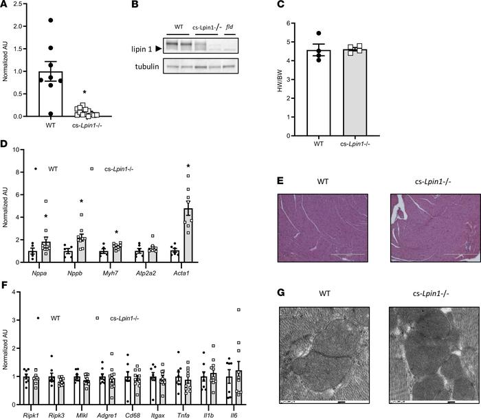 cs-Lpin1–/– mice are viable and exhibit minimal cardiac phenotype at bas...