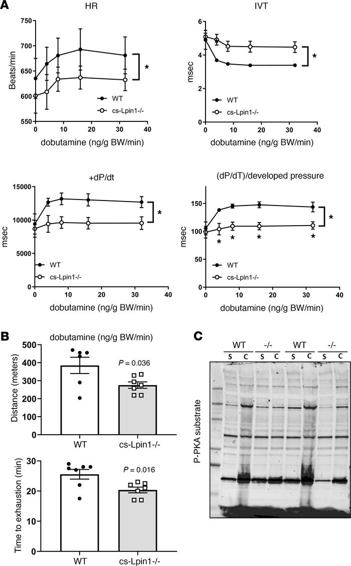 cs-Lpin1–/– mice exhibit reduced response to β-agonist stimulation.
(A) ...