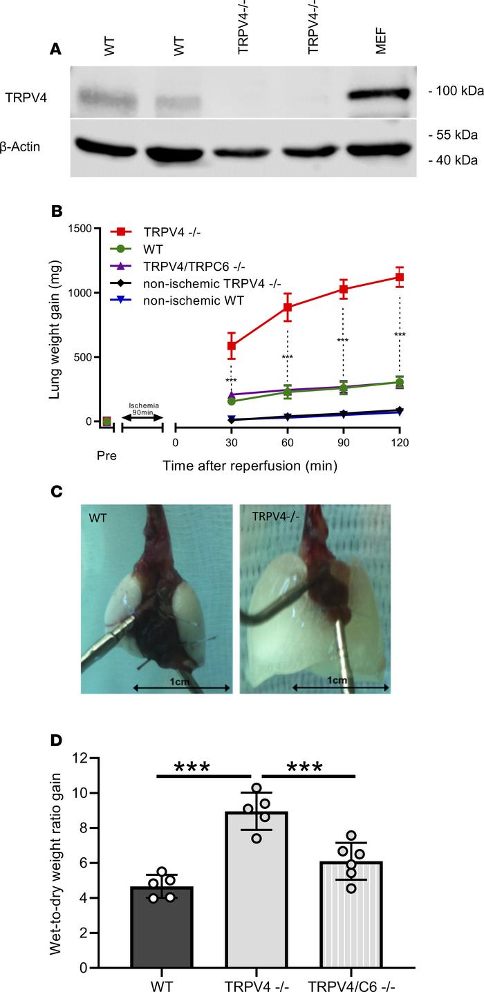 Ablation of TRPV4 increases ischemia-induced edema formation in mouse lu...