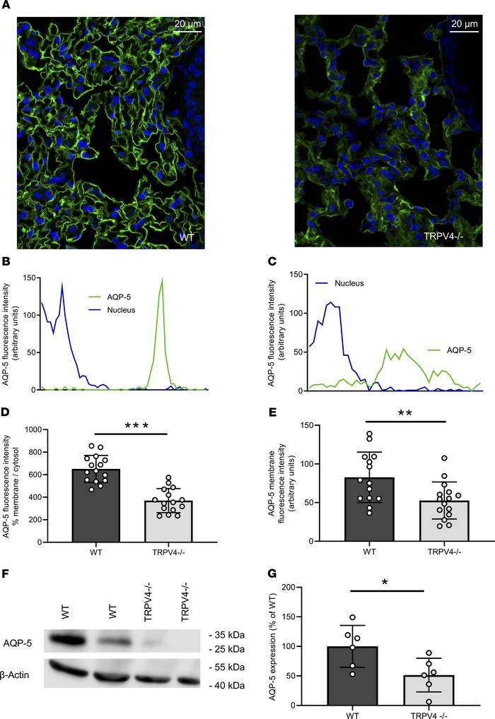 Aquaporin-5 expression and translocation to the plasma membrane in WT an...