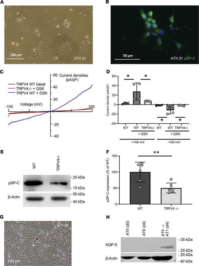 Identification of alveolar epithelial type II cells and differentiation ...