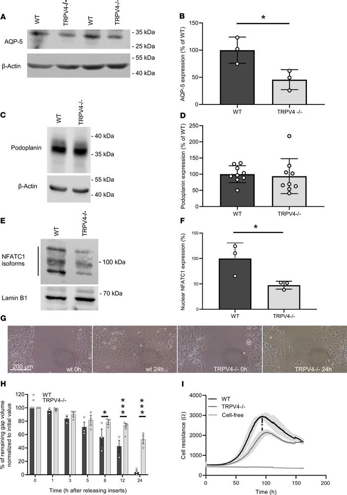 Nuclear localization of nuclear factor of activated T cells in and migra...