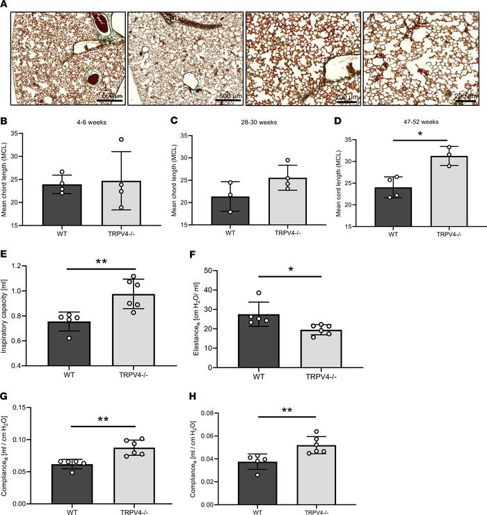 Chord lengths and lung function of WT and TRPV4–/– mice.
Representative ...