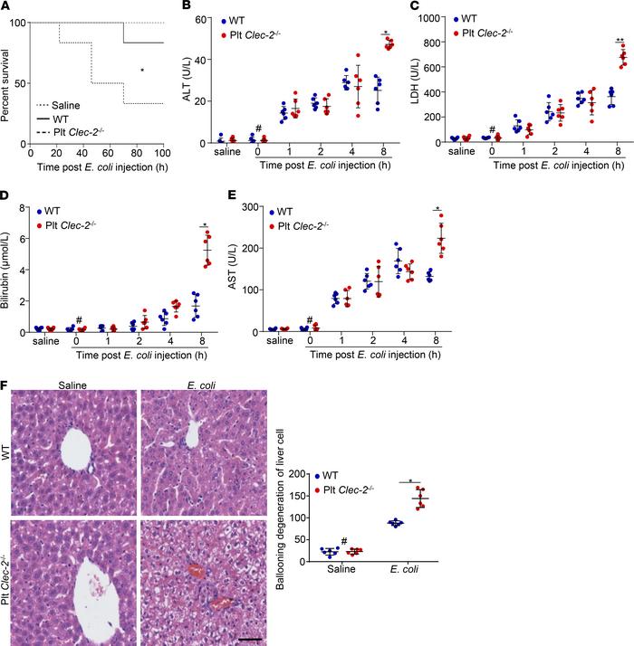 Platelet CLEC-2 deficiency enhances liver dysfunction in early sepsis.
(...