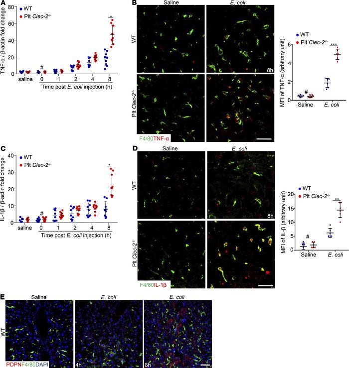 Platelet CLEC-2 deficiency increases liver inflammation in early sepsis....