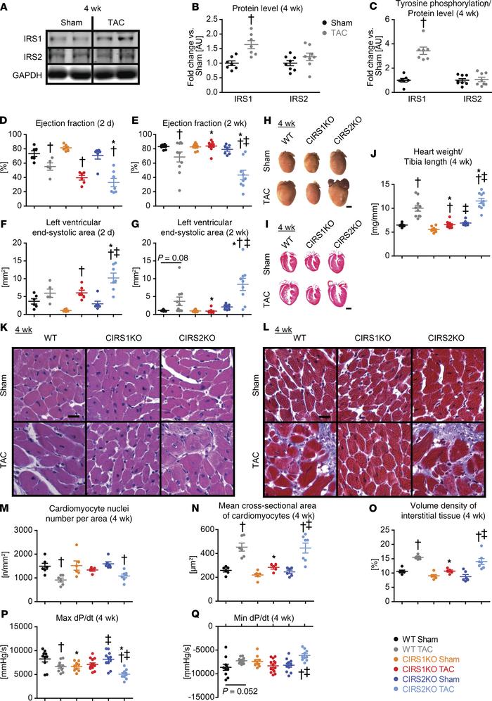IRS1, but not IRS2, is hyperactivated under pressure overload conditions...