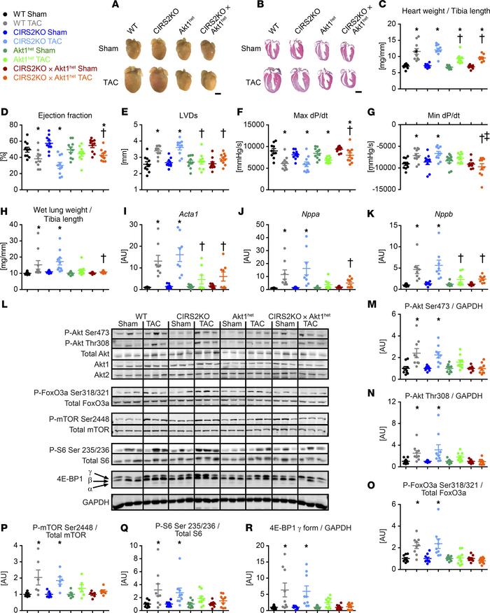 Heterozygous deletion of Akt1 prevents hyperactivation of the mTOR signa...