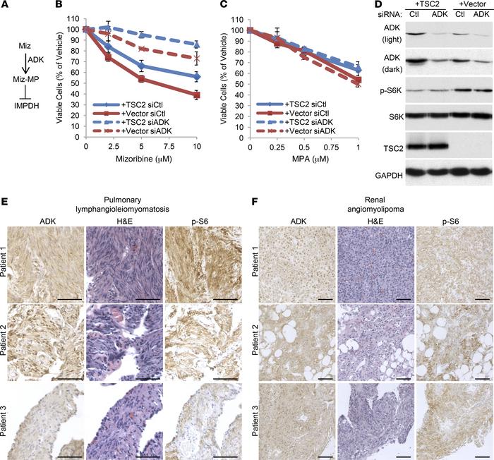 ADK, required for mizoribine action, is expressed in human TSC-associate...
