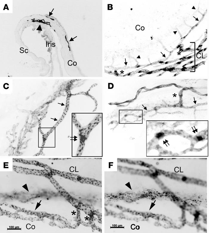 Spatial distribution of the limbal and conjunctival lymphatics and Schle...