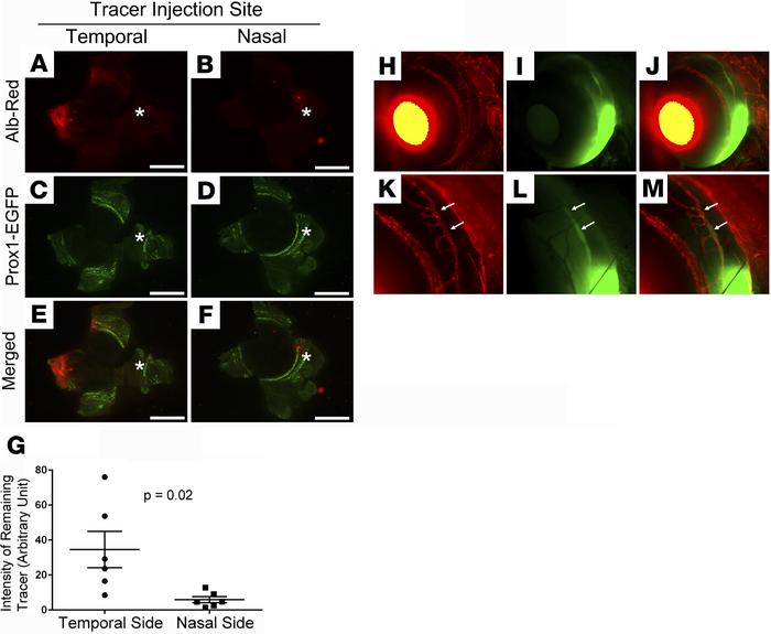 Faster fluid drainage in the nasal side compared with the temporal side....