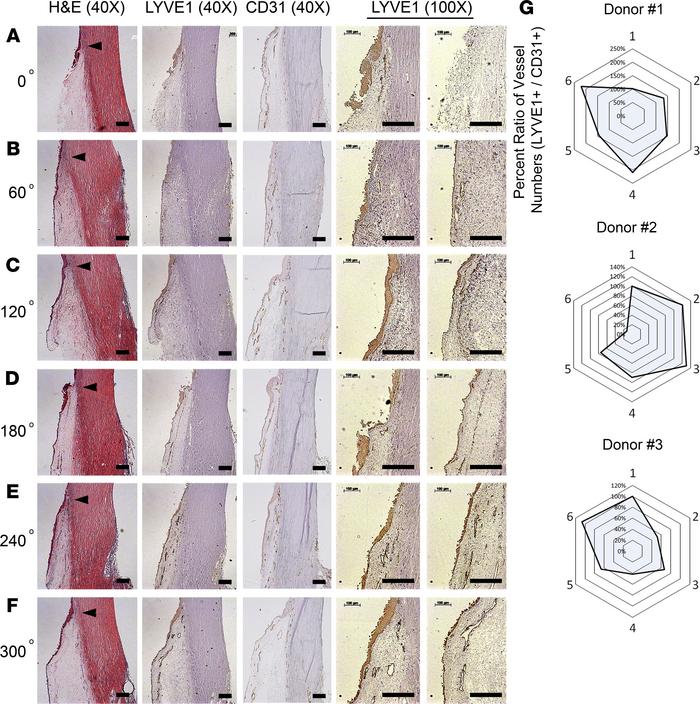 Distribution of conjunctival blood and lymphatic vessels in the anterior...