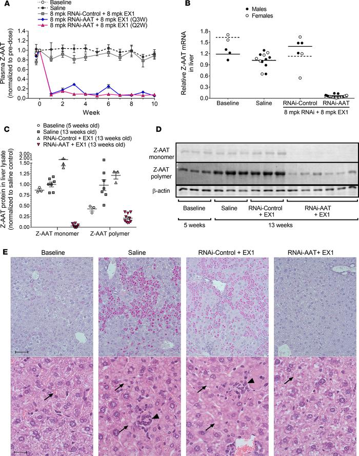 RNAi-mediated reduction of Z-AAT protein and mRNA in young PiZ mouse liv...