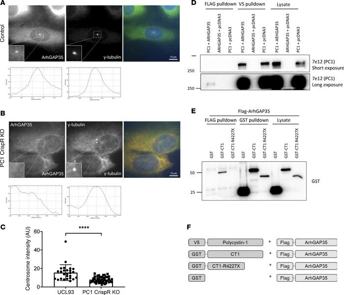 Centrosomal ARHGAP35 interacts with PC1.
(A–C) Centrosomal ARHGAP35 expr...