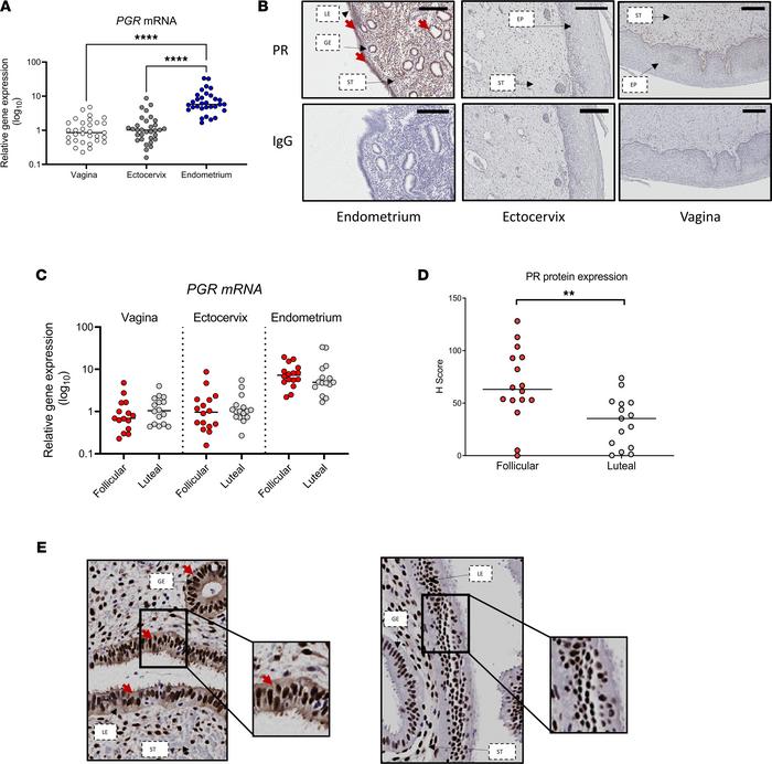 Expression of PR selective and cyclic changes only in upper hFRT.
(A)PR ...