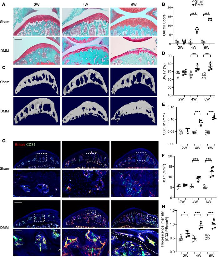 Aberrant subchondral bone angiogenesis develops at preosteoarthritis and...