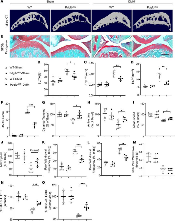Conditional PDGF-BB-knockout mice are protected from joint damage.
Three...