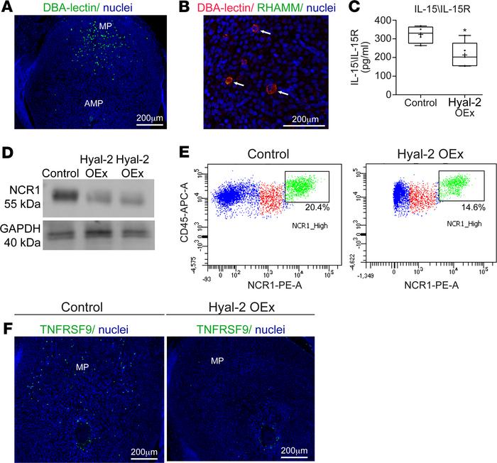 Trophoblast Hyal-2 overexpression impairs uterine NK cell recruitment an...