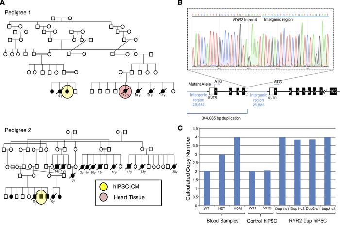 Amish pedigrees with recessively inherited exertion-associated SUDY.
Sho...