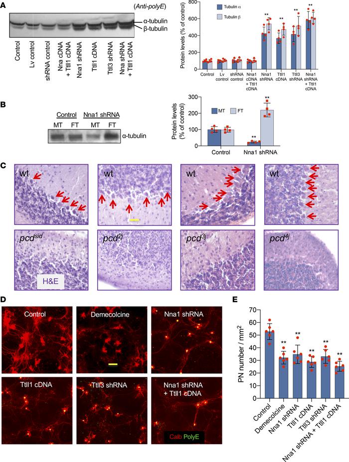 Tubulin hyperglutamylation and PN death.
(A) Glutamylated tubulins incre...