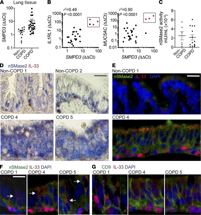 Neutral sphingomyelinase 2 in COPD.
(A) SMPD3 qPCR in non-COPD (n = 12) ...