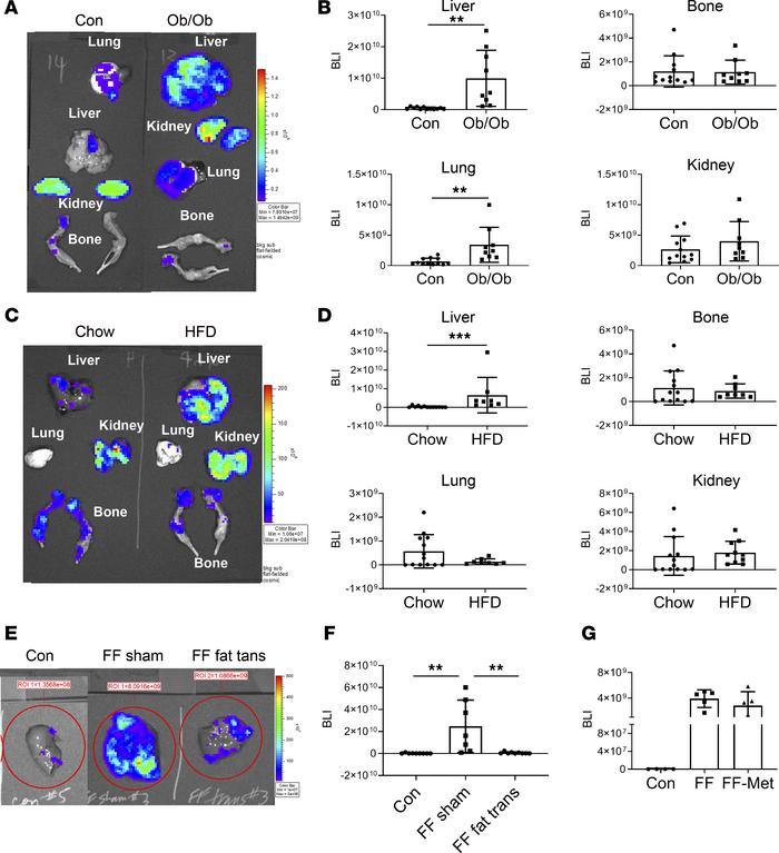 Obese mice are predisposed to hepatic metastasis.
(A and B) Two-month-ol...