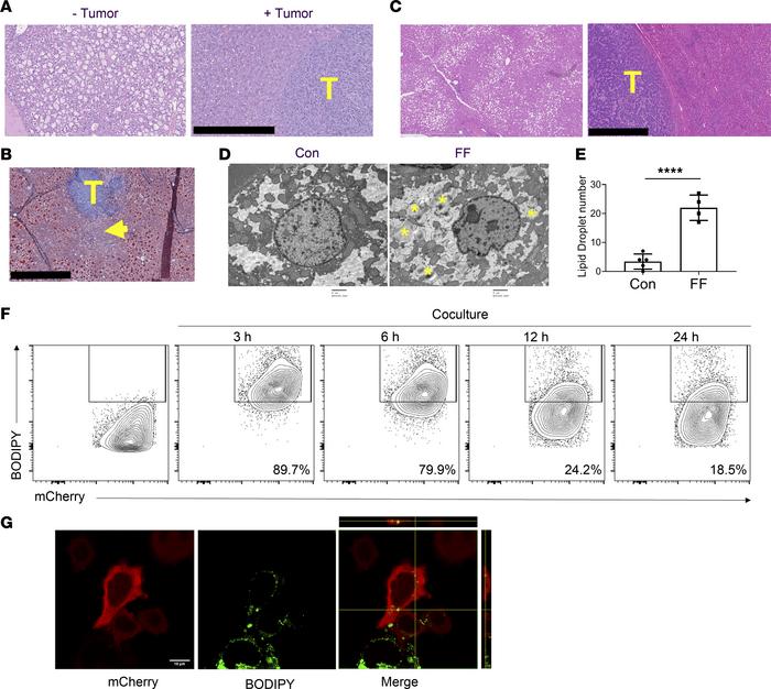 Steatotic hepatocytes transfer lipids to tumor.
(A) H&amp;E staining of ...