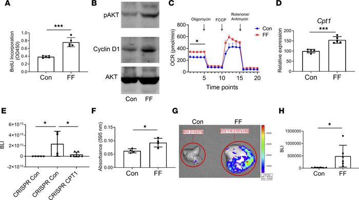 Steatosis promotes metastatic tumor growth.
(A) BrdU incorporation and (...