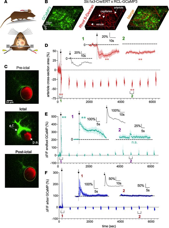 Seizure-induced sustained arteriole constriction is associated with an i...