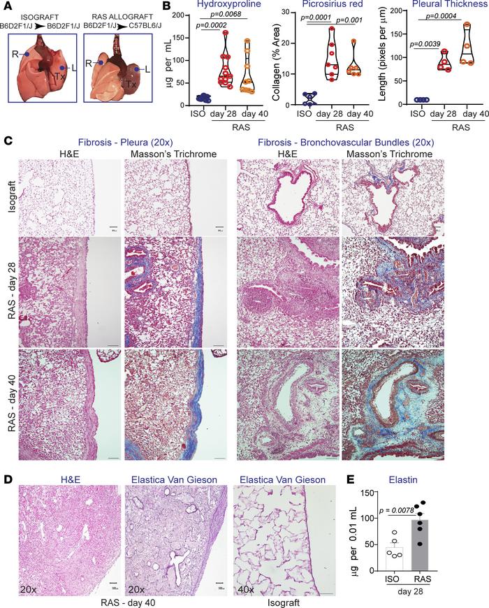 Murine orthotopic lung transplant model of F1 → parent (B6D2F1/J → C57BL...