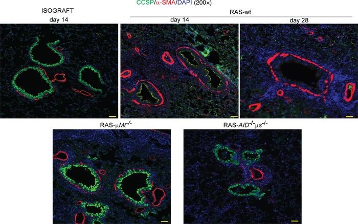 Epithelial mesenchymal tropic unit as a target of humoral immune respons...
