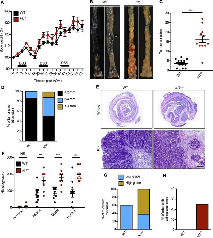 IRF1 prevents colitis-associated colorectal tumorigenesis.
(A) Body weig...
