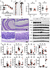 IRF1 does not regulate inflammation in the colon.