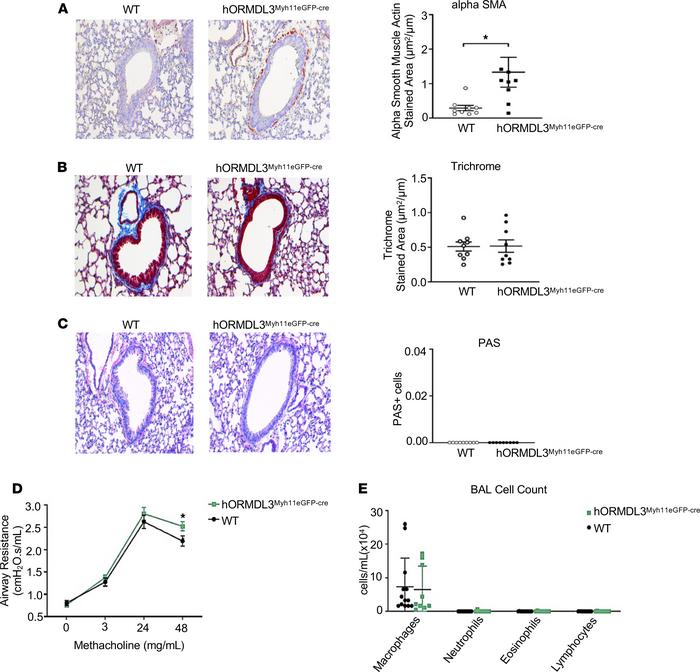 Effect of ORMDL3 on airway remodeling, AHR, and airway inflammation in v...