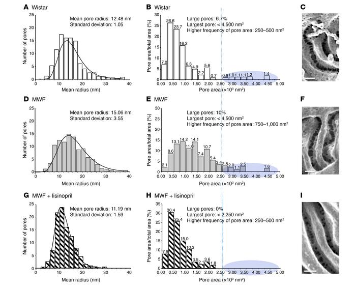 ACEi treatment reduced mean pore radius in MWF rats.
Distribution of sli...