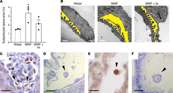 ACEi reduced SPS in proteinuric MWF animals.
(A) Quantification of SPS a...