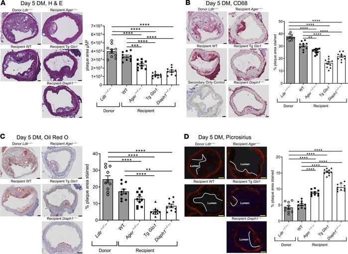 RAGE, GLO1, DIAPH1, and regression of atherosclerosis.
Representative im...