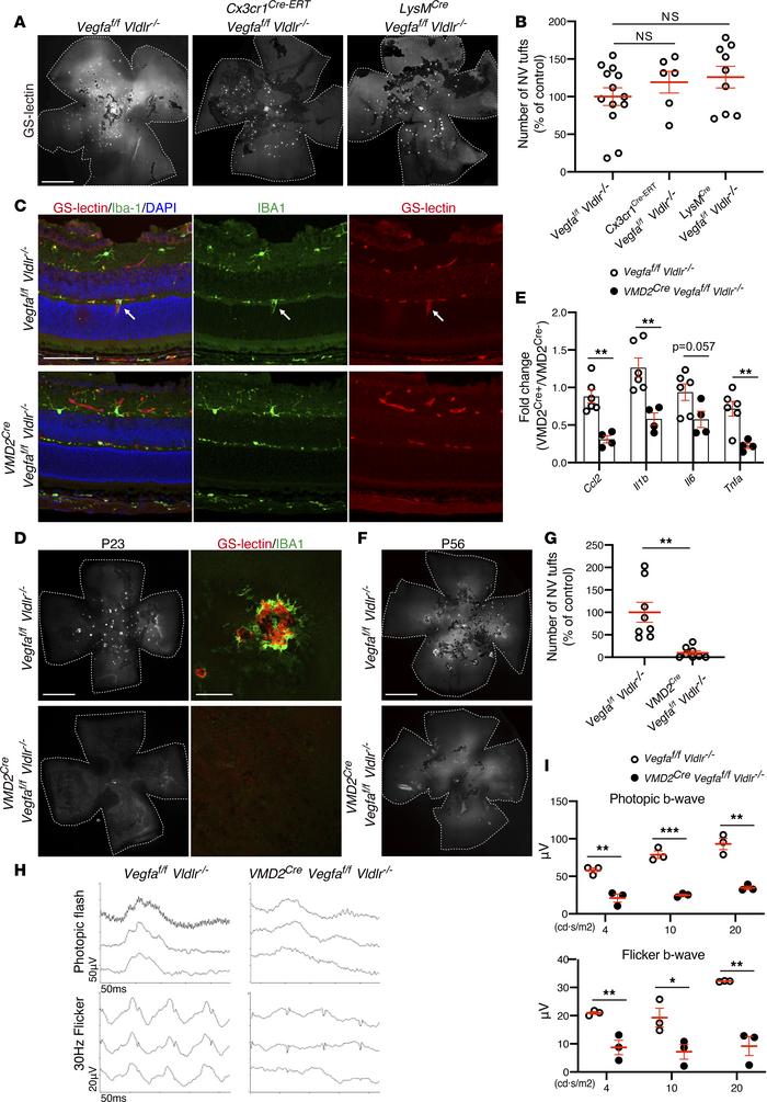 
Vegfa deletion in RPE, but not microglia/macrophages, inhibits neovascu...