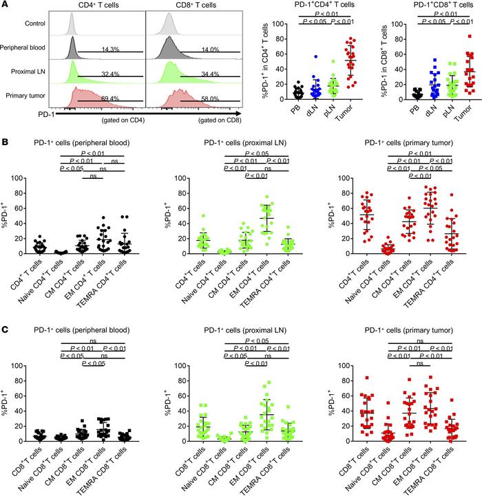 PD-1 expression by T cells in PBLs, LNLs, and TILs.
PBLs, LNLs, and TILs...