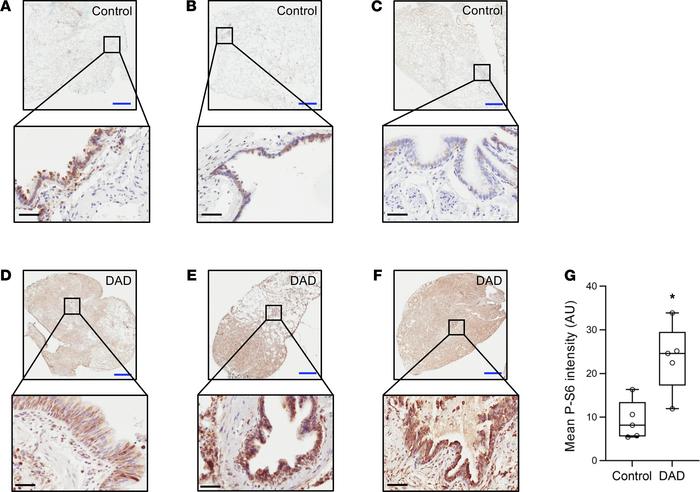 mTORC1 is activated in lung tissue from mechanically ventilated patients...