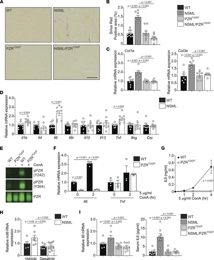 PZR tyrosyl phosphorylation promotes myocardial fibrosis and positively ...