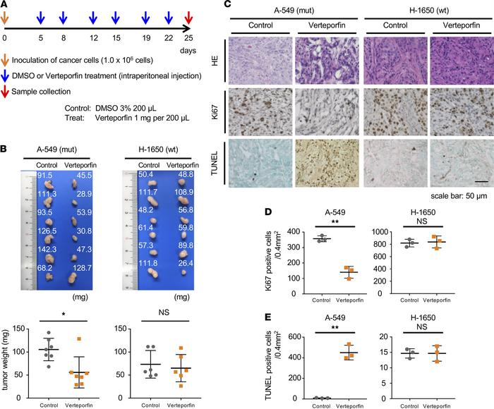 Verteporfin exerts apoptotic effects in KRAS-mutant cells in vivo.
(A) S...
